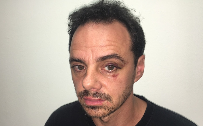 Brutálisan megverték a Madách Színház ismert színészét - Az egyik támadó után még hajtóvadászat zajlik 