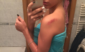 VV Izát verte, fojtogatta egykori villatársa VV Krisztián  