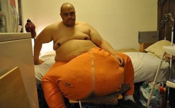 Eltávolították 75 kilogrammos herezacskóit - Videó! 