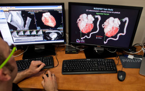 Szívinfarktus és öröklődés: egyedülálló kutatás ikrek körében