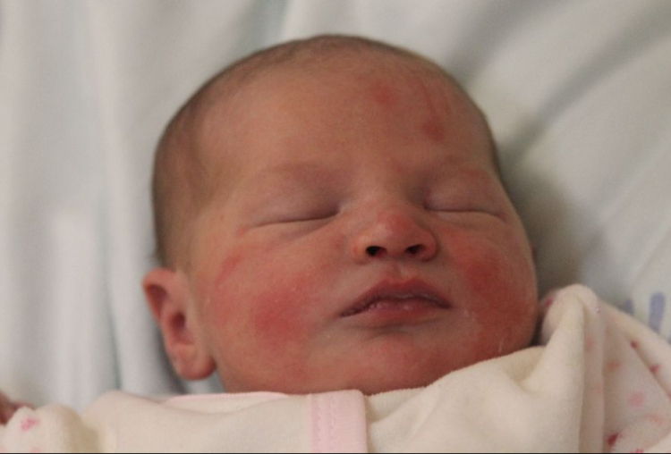 Herczeg Renáta Lídia 