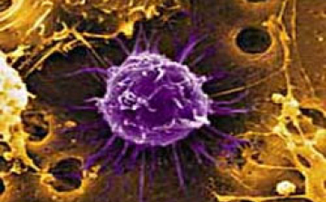 Az őssejtinfúzió segíthet az agyi érkatasztrófa utáni felépülésben