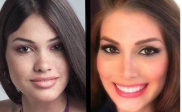 Hajdú Péter kiakadt a plasztikázott győztesre