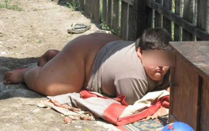 Meghalt a moslékon hizlalt kisfiú