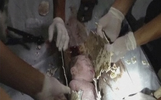 Csecsemőt találtak egy szennycsatornában - Videó!