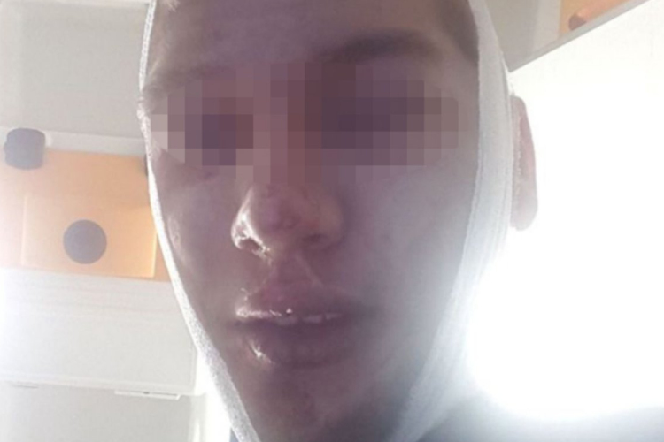 30 afgán migráns támadt meg két osztrákot Bécsben