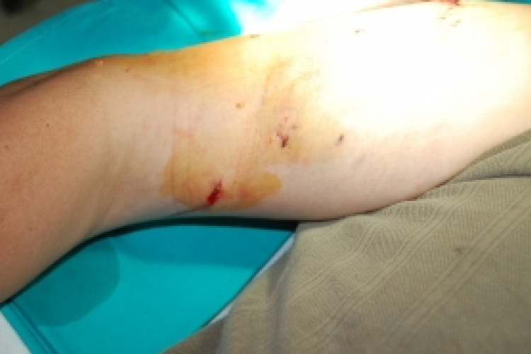 Az utcáján marcangolta a helyi férfit a kaukázusi juhászkutya