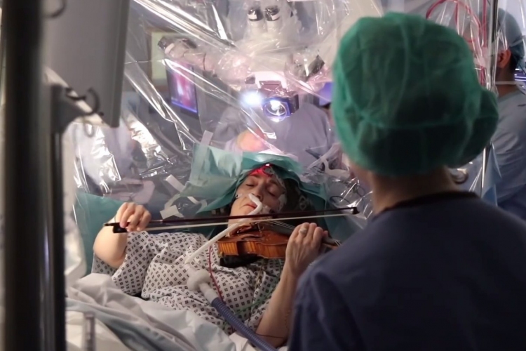 Agyműtéte közben hegedült egy nő