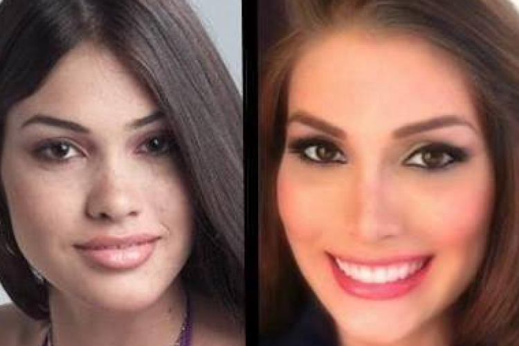 Hajdú Péter kiakadt a plasztikázott győztesre