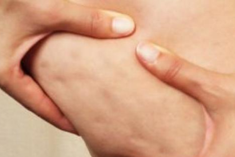 Masszírozással a narancsbőr ellen