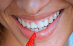 Fogászat vagy művészet? Mosolyogjon bátran!