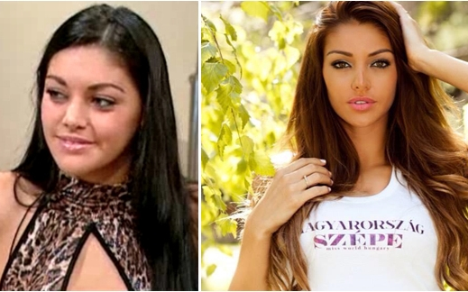 Plasztikázott Magyarország Szépe