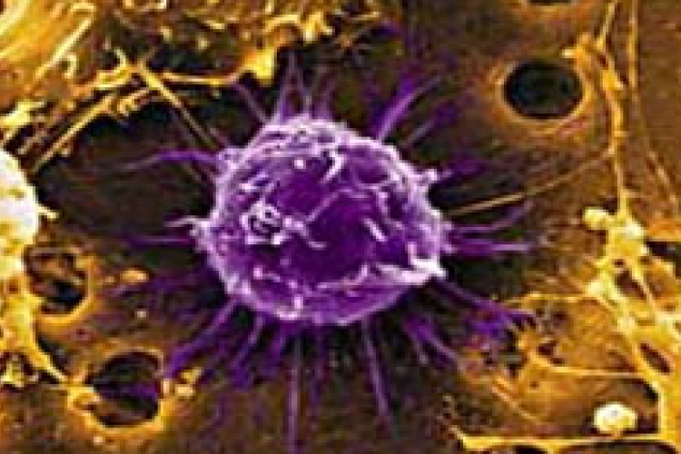 Az őssejtinfúzió segíthet az agyi érkatasztrófa utáni felépülésben