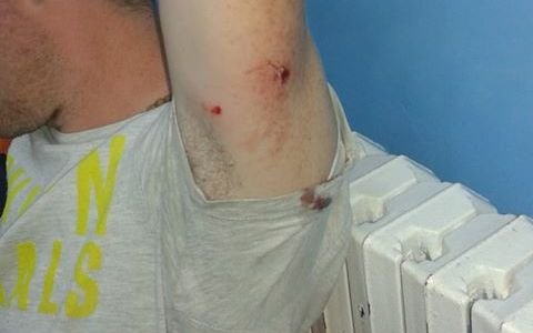 Megtámadt egy medve egy embert Tusnádfürdőn