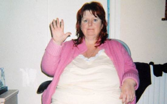 Túlsúlya miatt megműtötték, ám most az éhenhalás fenyegeti