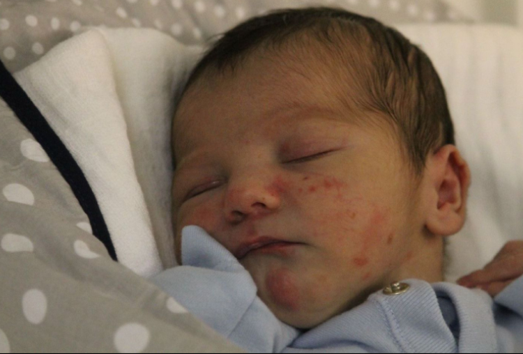 Szeredi-Fehér Lehel 