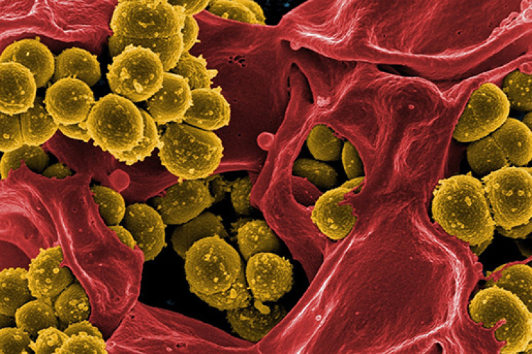 Táplálkozási tanácsok Novák Pétertől-28. rész: Pre- Pro- … és kontra