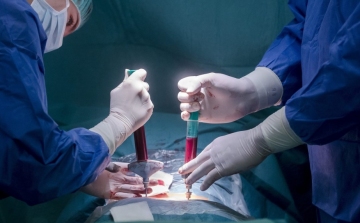 Őssejt-transzplantációval fordítottak vissza egy autoimmun betegséget