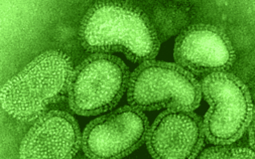 Influenza - Látogatási tilalom a győri kórházban