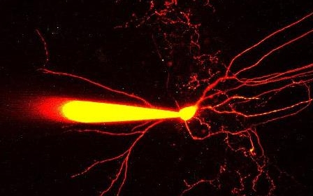 Magyar agykutatók a gátló idegsejtek egyedülálló vizsgálati módszerét dolgozták ki