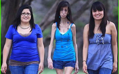 20 percenként eszik, napi hatvanszor, mégis 26 kiló a nő