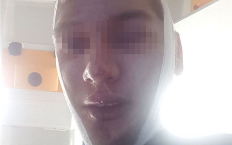 30 afgán migráns támadt meg két osztrákot Bécsben