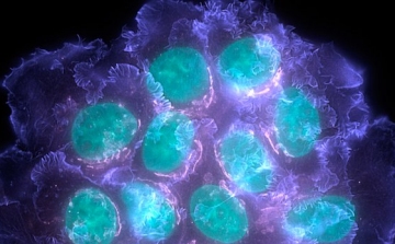Egy daganaton belül sokféle rákos sejt lehet egy kutatás szerint