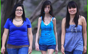 20 percenként eszik, napi hatvanszor, mégis 26 kiló a nő