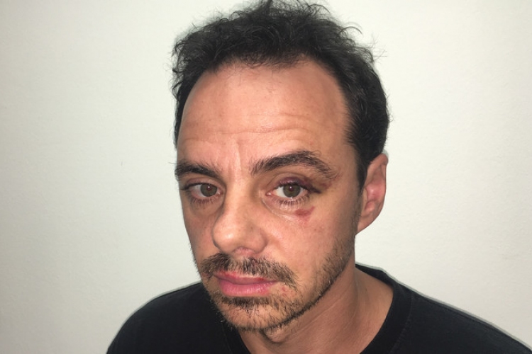 Brutálisan megverték a Madách Színház ismert színészét - Az egyik támadó után még hajtóvadászat zajlik 